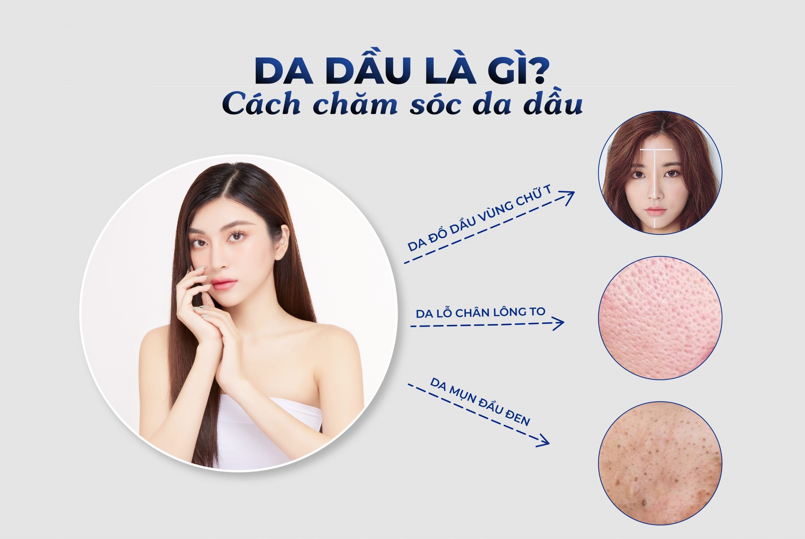 Chăm Sóc Da Dầu Thế Nào Cho Đúng Chuẩn?